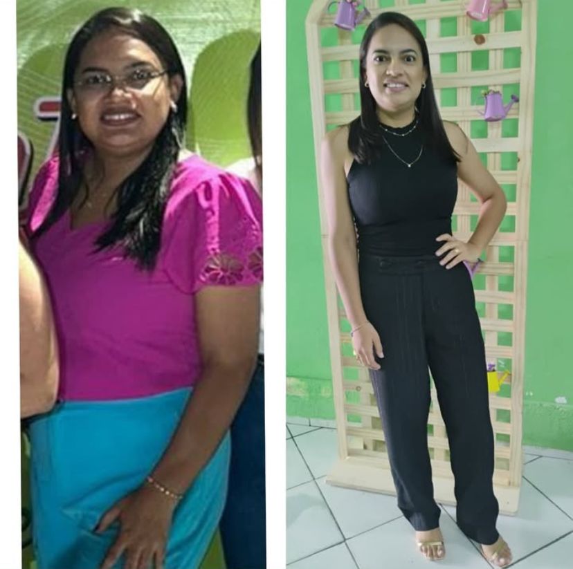 Registro de antes e depois com duas fotografias em roupas casuais, lado a lado.